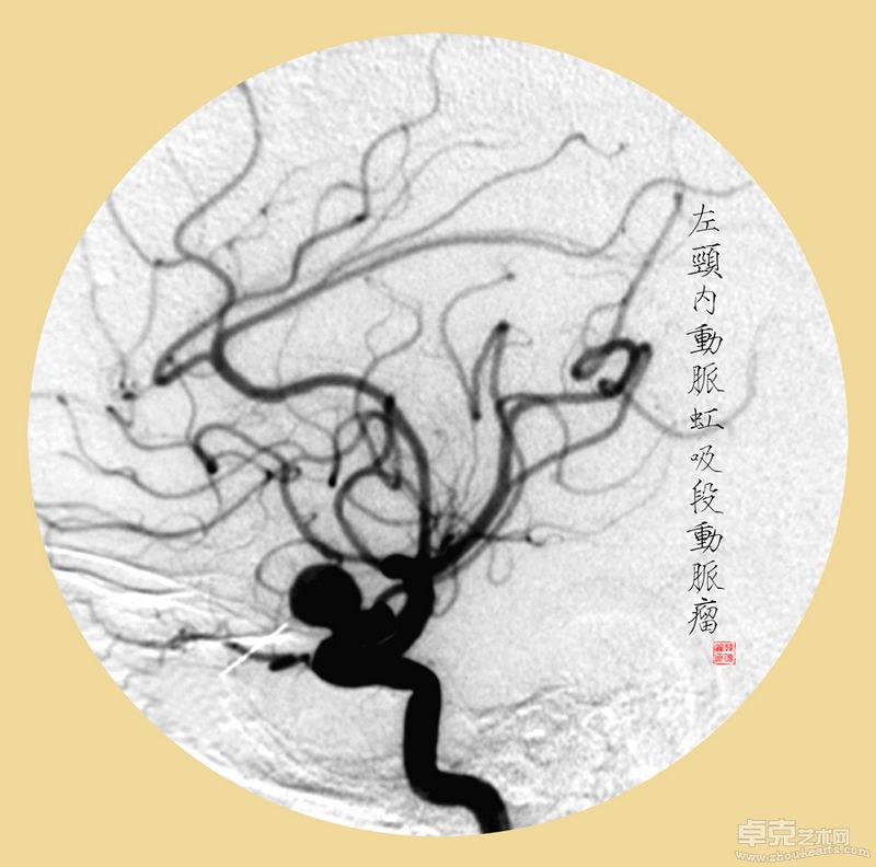 韩晓丽-殇40X40cmX11 （观念摄影） (10)