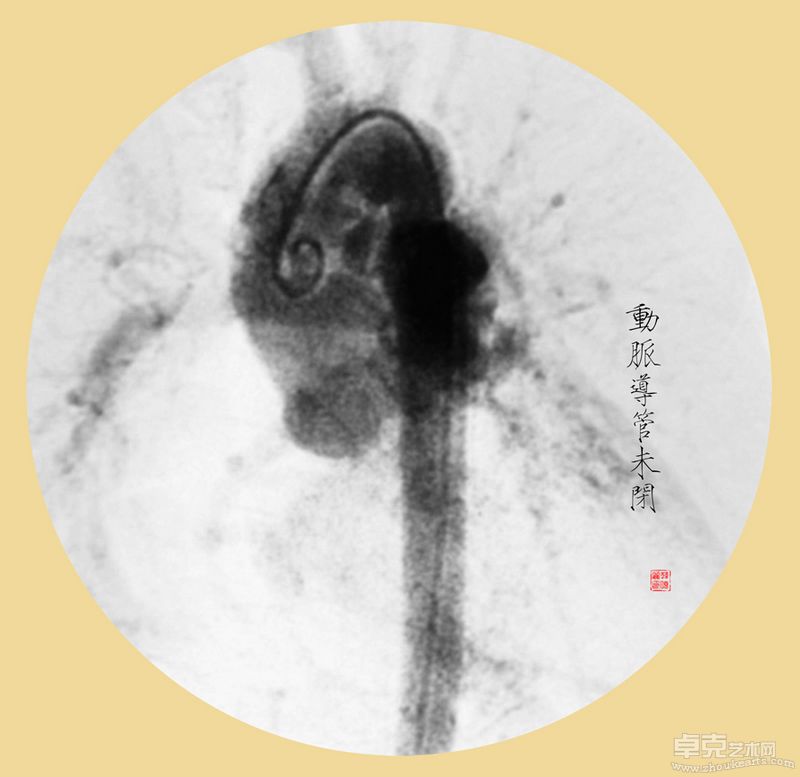 韩晓丽-殇40X40cmX11 （观念摄影） (9)