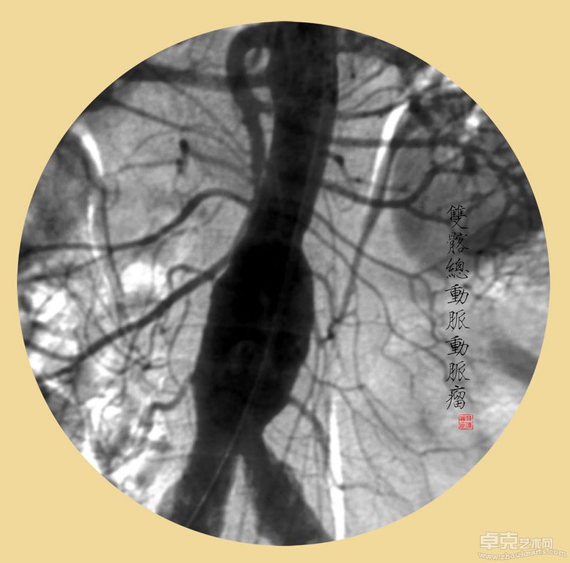 韩晓丽-殇40X40cmX11 （观念摄影） (8)