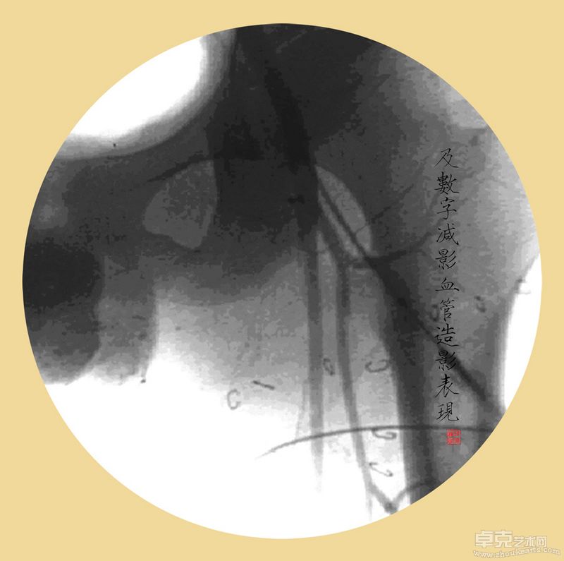 韩晓丽-殇40X40cmX11 （观念摄影） (7)