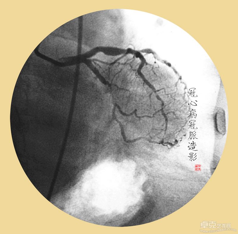 韩晓丽-殇40X40cmX11 （观念摄影） (6)