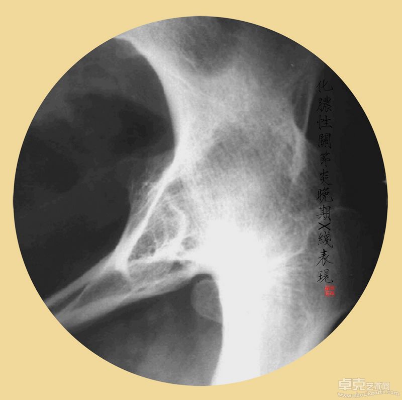 韩晓丽-殇40X40cmX11 （观念摄影） (4)