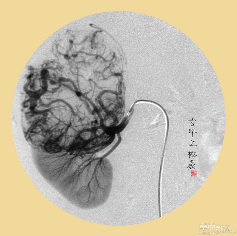 韩晓丽-殇40X40cmX11 （观念摄影） (2)