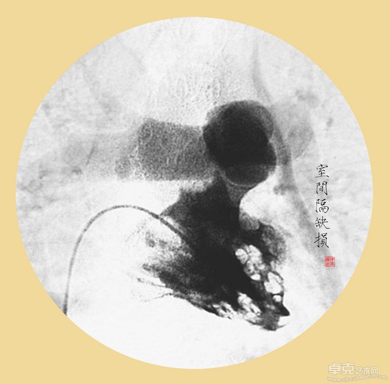 韩晓丽-殇40X40cmX11 （观念摄影） (1)